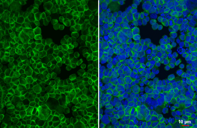 Anti-Glycophorin A antibody [HL6300] used in Immunocytochemistry/ Immunofluorescence (ICC/IF). GTX648402